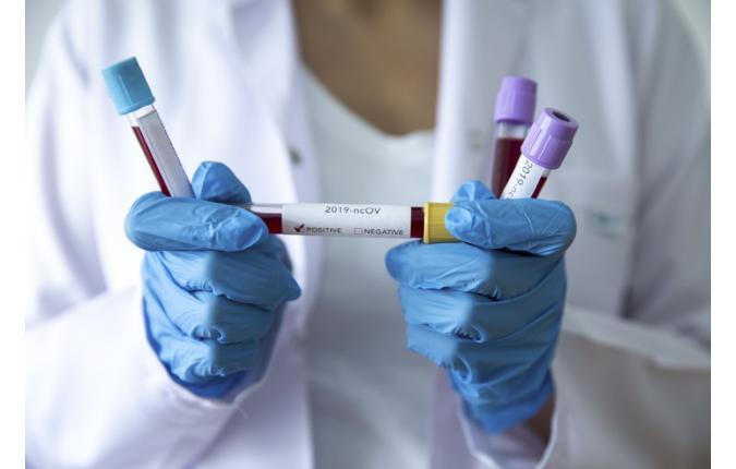 KORONAVIRUS informacije