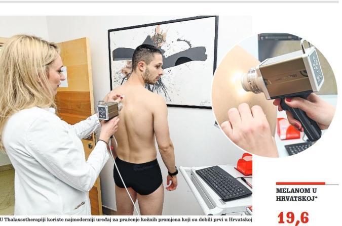 N. LIST : DR. TEA ROSOVIĆ O PREVENCIJI I LIJEČENJU ZLOĆUDNOG TUMORA KOŽE