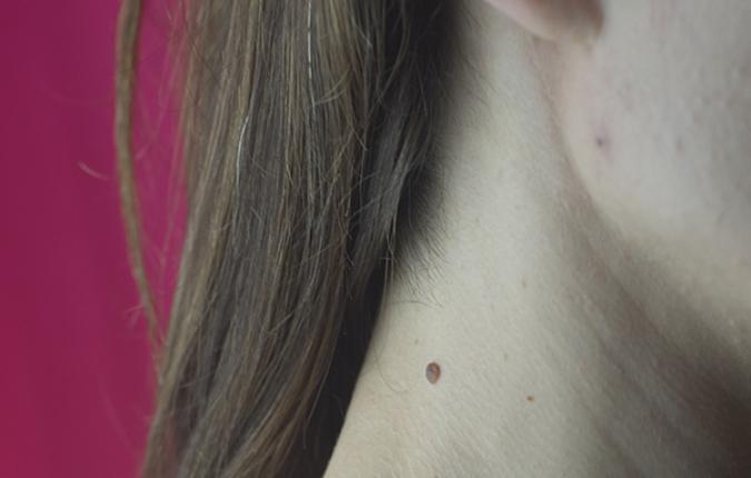 Dermatologija