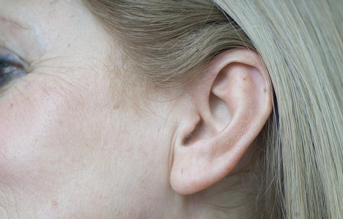 Korekcija ušiju  (otoplastika)