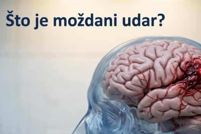 Svjetski dan moždanog udara (29. listopada)