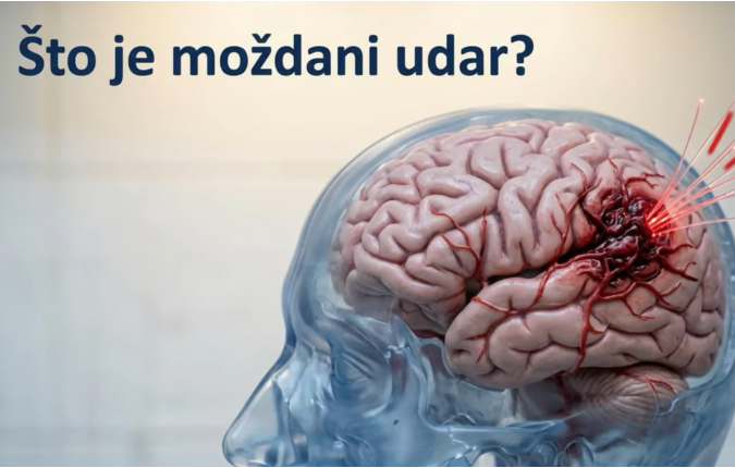Svjetski dan moždanog udara ( 29. listopada 2026.)