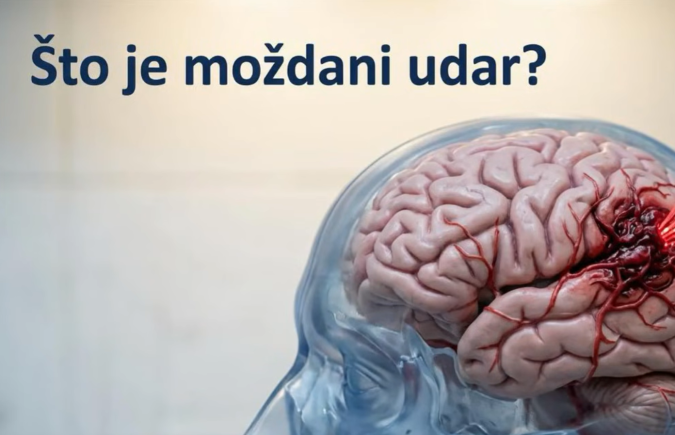 Svjetski dan moždanog udara (29. listopada)