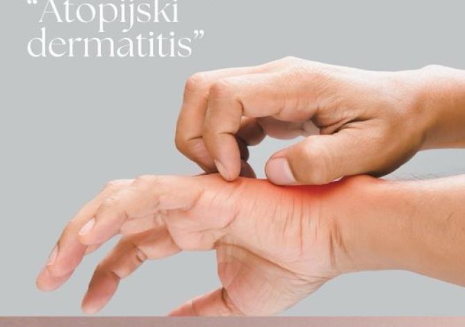 Stručni skup Atopijski dermatitis 22.05. 2024.
